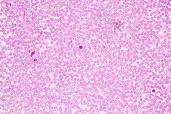 Adobe Stock 232084334 6307cdb1dedfe Adobe Stock 232084334 6307cdb1dedfe