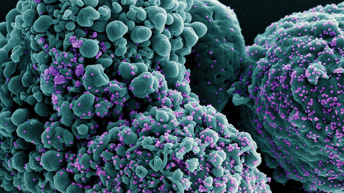 Colorized scanning electron micrograph of a cell infected with the Omicron strain of SARS-CoV-2 virus particles (purple), isolated from a patient sample. NIAID.