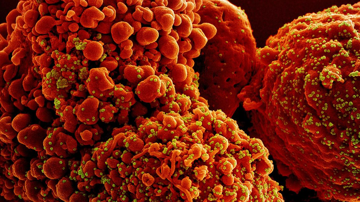Colorized scanning electron micrograph of a cell infected with the Omicron strain of SARS-CoV-2 virus particles (yellow and green), isolated from a patient sample. NIAID.