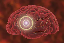 Dreamstime Xxl 111511249 63f3f3a223de5 Dreamstime Xxl 111511249 63f3f3a223de5