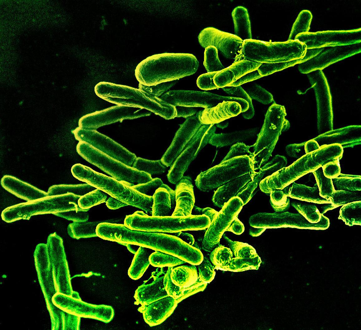 Scanning electron micrograph of Mycobacterium tuberculosis bacteria, which cause TB. NIAID.