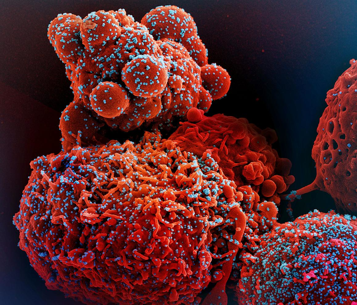 Colorized scanning electron micrograph of a cell (red) infected with the Omicron strain of SARS-CoV-2 virus particles (blue), isolated from a patient sample. NIAID.