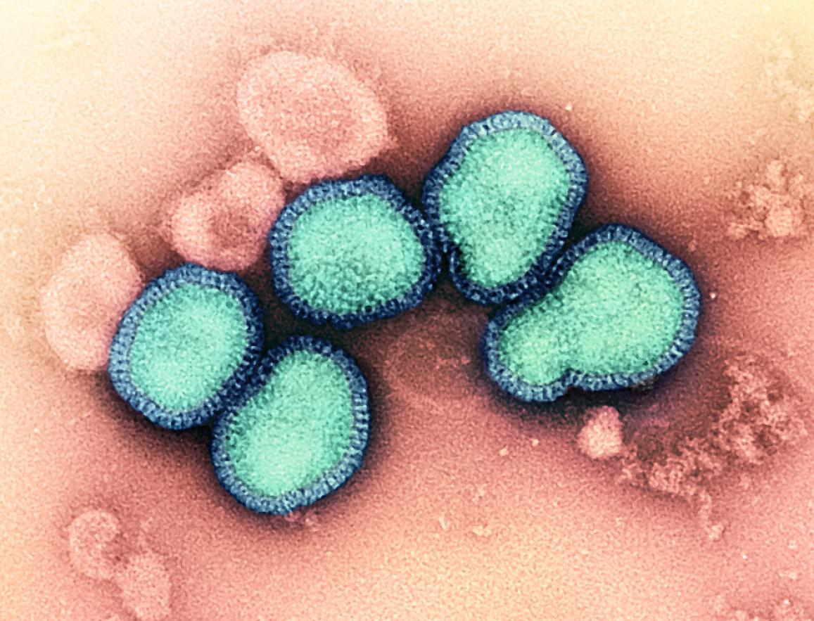 Influenza A Virus (H3N2), NIAID.
