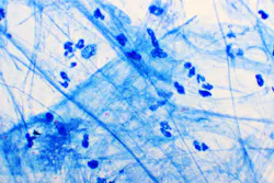 Dreamstime Xxl 165320191 645cf9f11311c Dreamstime Xxl 165320191 645cf9f11311c