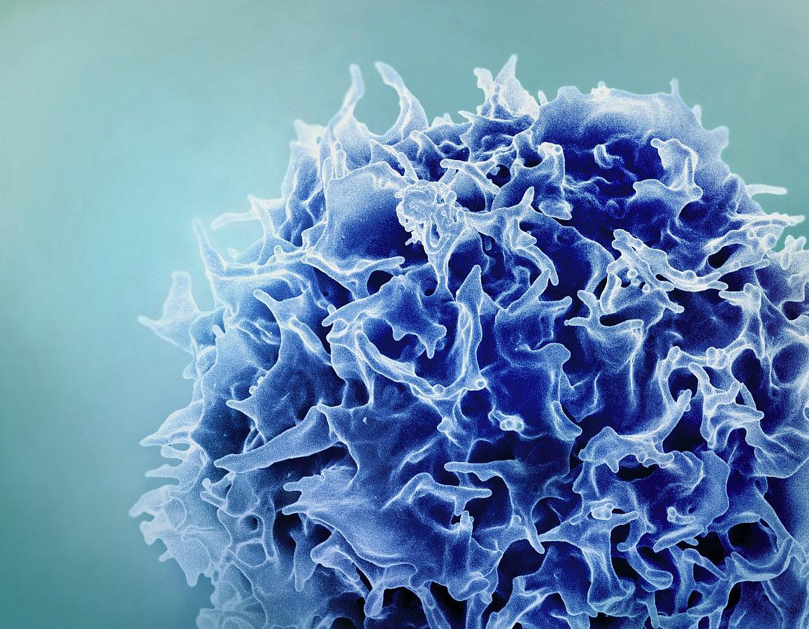 Colorized scanning electron micrograph of a T lymphocyte (also known as a T cell) (blue). NIAID.