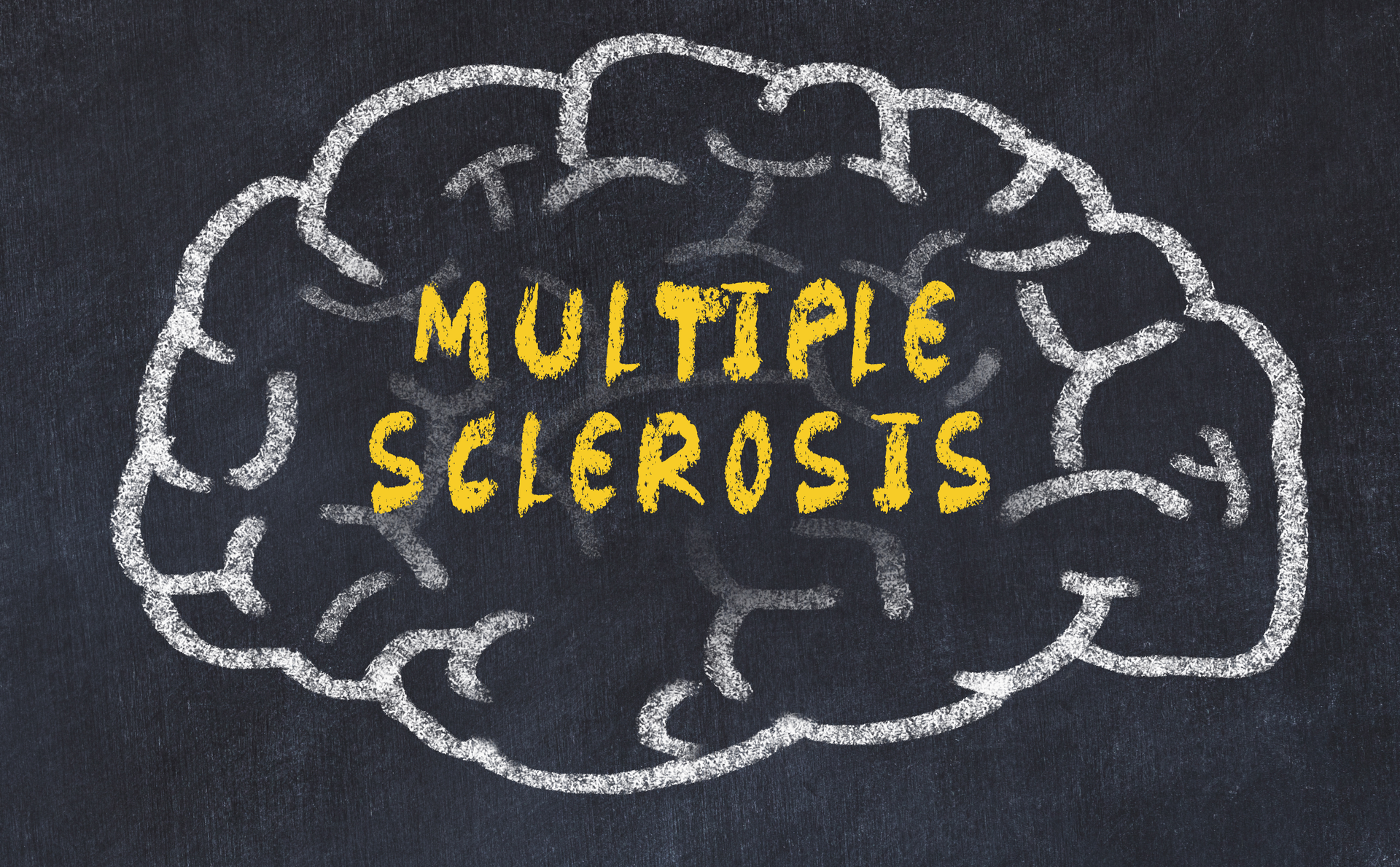 Dreamstime Xxl 147545411 64a2cbf5b0197