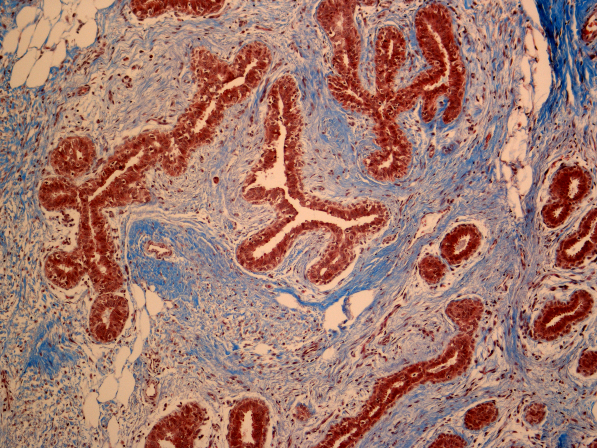 Dreamstime Xxl 44133974 64a8271696c1c