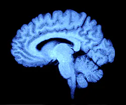 Dreamstime Xl 4963114 64ee0f4e24805 Dreamstime Xl 4963114 64ee0f4e24805