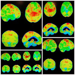 654bb0346bac49001e27f6d2 Dreamstime Xxl 73712058 654bb0346bac49001e27f6d2 Dreamstime Xxl 73712058