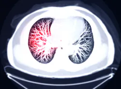 6566141b2ad094001e3ad108 Dreamstime Xxl 179593641 6566141b2ad094001e3ad108 Dreamstime Xxl 179593641