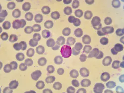 656a1352704454001e01baa4 Dreamstime 99829516 656a1352704454001e01baa4 Dreamstime 99829516