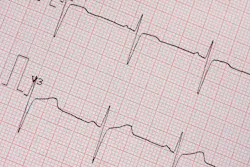 6596d316a89e42001e438f91 Dreamstime Xxl 30337068 6596d316a89e42001e438f91 Dreamstime Xxl 30337068