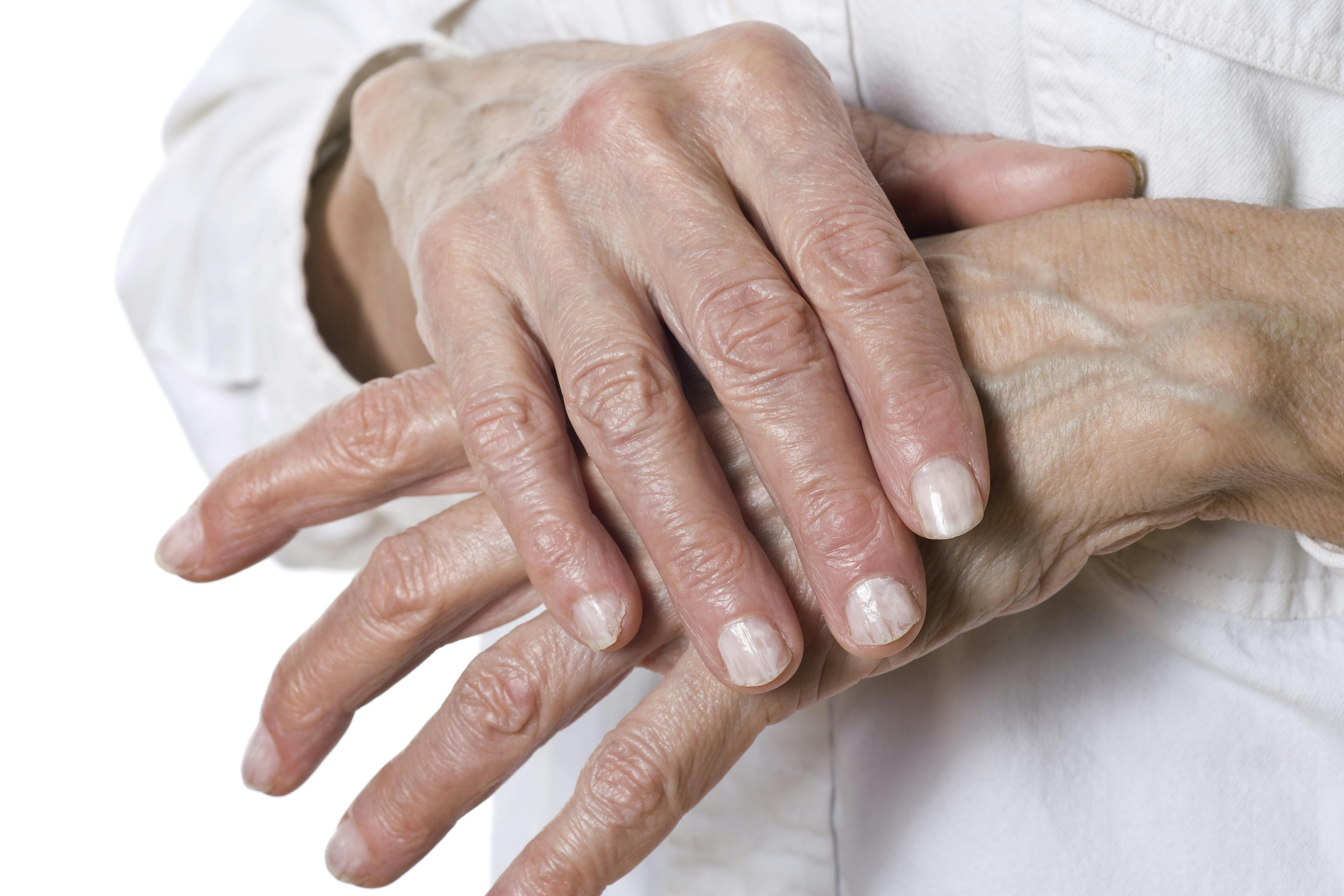 664e05428f5d368eb929c6ec Dreamstime Xxl 8287100