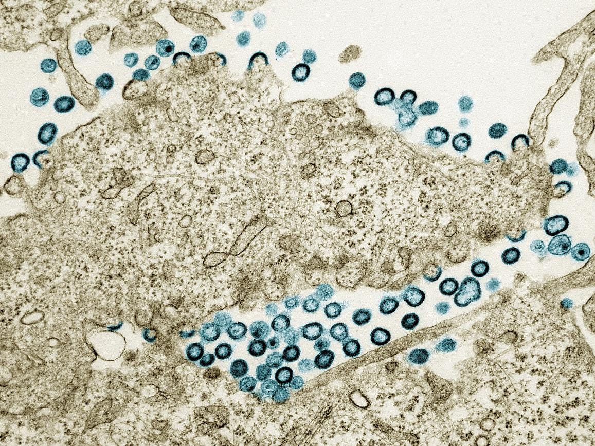 Transmission electron micrograph of HIV-1 virus particles (teal) budding and replicating from a segment of a chronically infected H9 cell (tan). Image captured at the NIAID Integrated Research Facility in Fort Detrick, Maryland. NIAID.