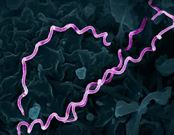 Colorized electron micrograph of Treponema pallidum, the bacteria that cause syphilis. Several spiral-shaped bacteria have been highlighted in pink. NIAID. Colorized electron micrograph of Treponema pallidum, the bacteria that cause syphilis. Several spiral-shaped bacteria have been highlighted in pink. NIAID.