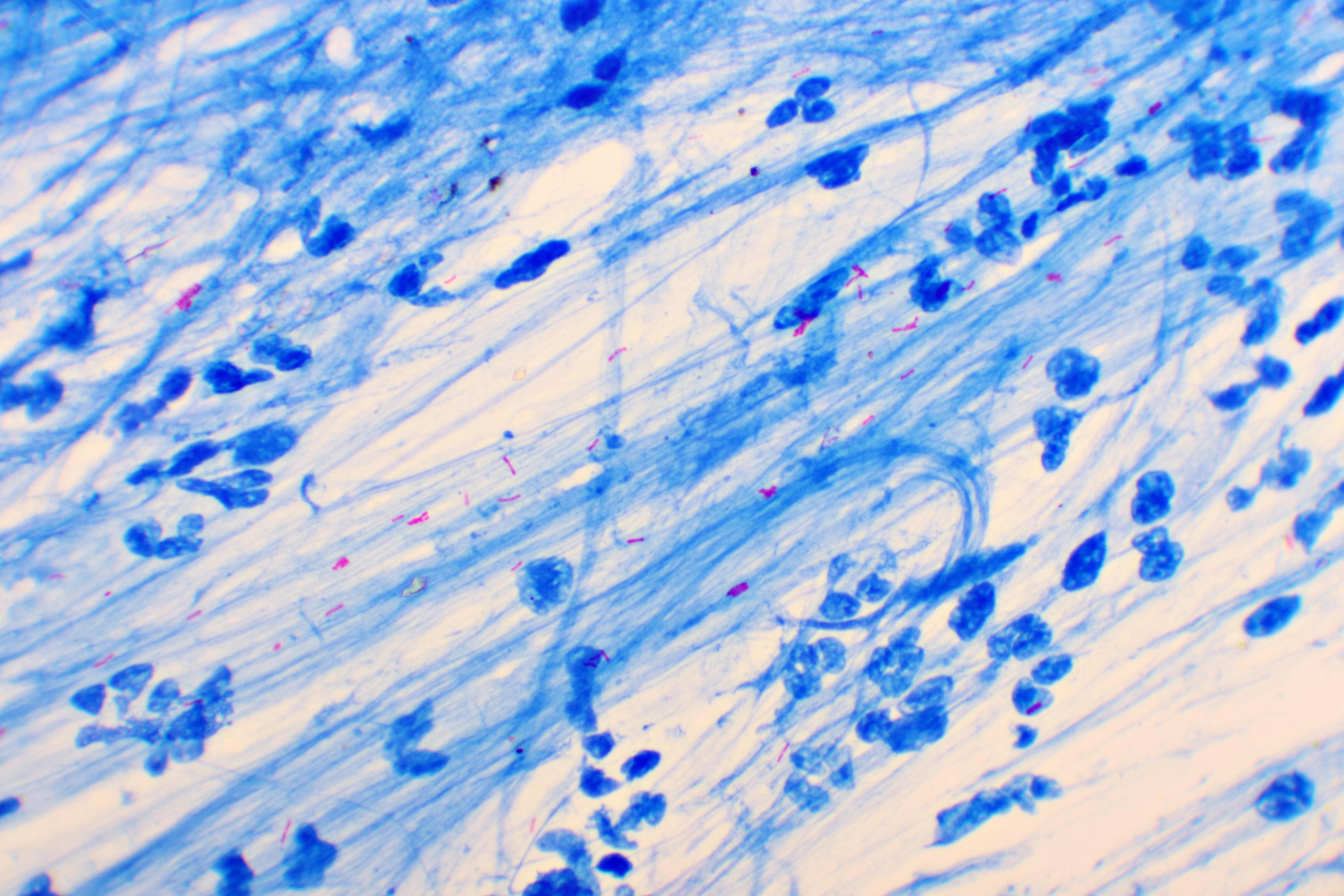 67224280e709c4772f06c52c Dreamstime Xxl 174325726