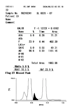 Figure 2. Cation exchange HPLC analyzer for HbA1c testing: HbF < 25%. Figure 2. Cation exchange HPLC analyzer for HbA1c testing: HbF < 25%.