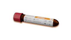 immuno_smart_randox immuno_smart_randox