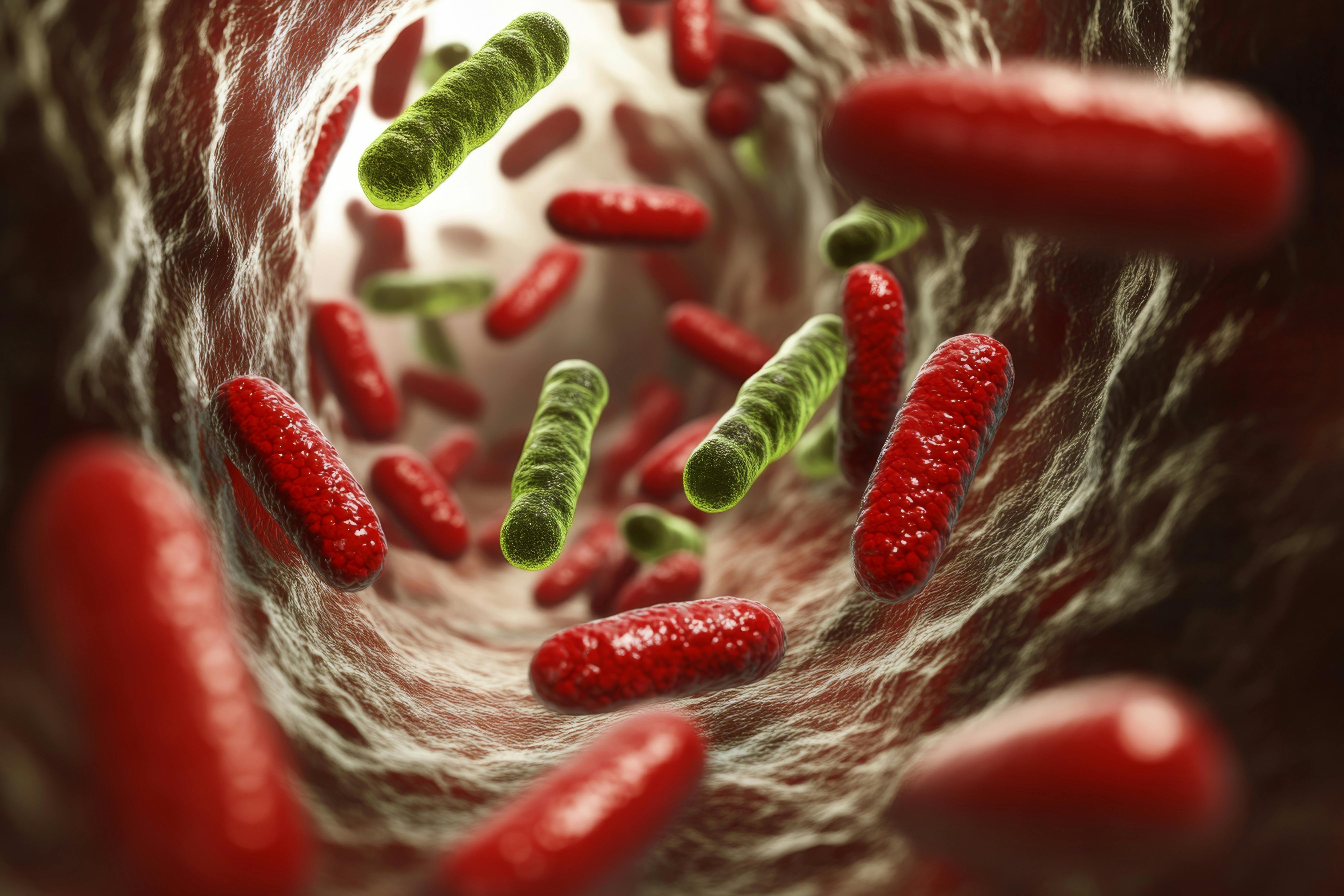 dreamstime_xxl_336482967