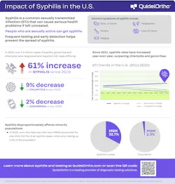 qo25_sti_chart qo25_sti_chart