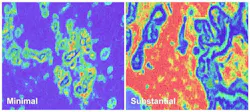 Slides showing minimal disruption (left) and substantial disruption (right) in breast stromal tissue. Courtesy of NIH/NCI. Slides showing minimal disruption (left) and substantial disruption (right) in breast stromal tissue. Courtesy of NIH/NCI.