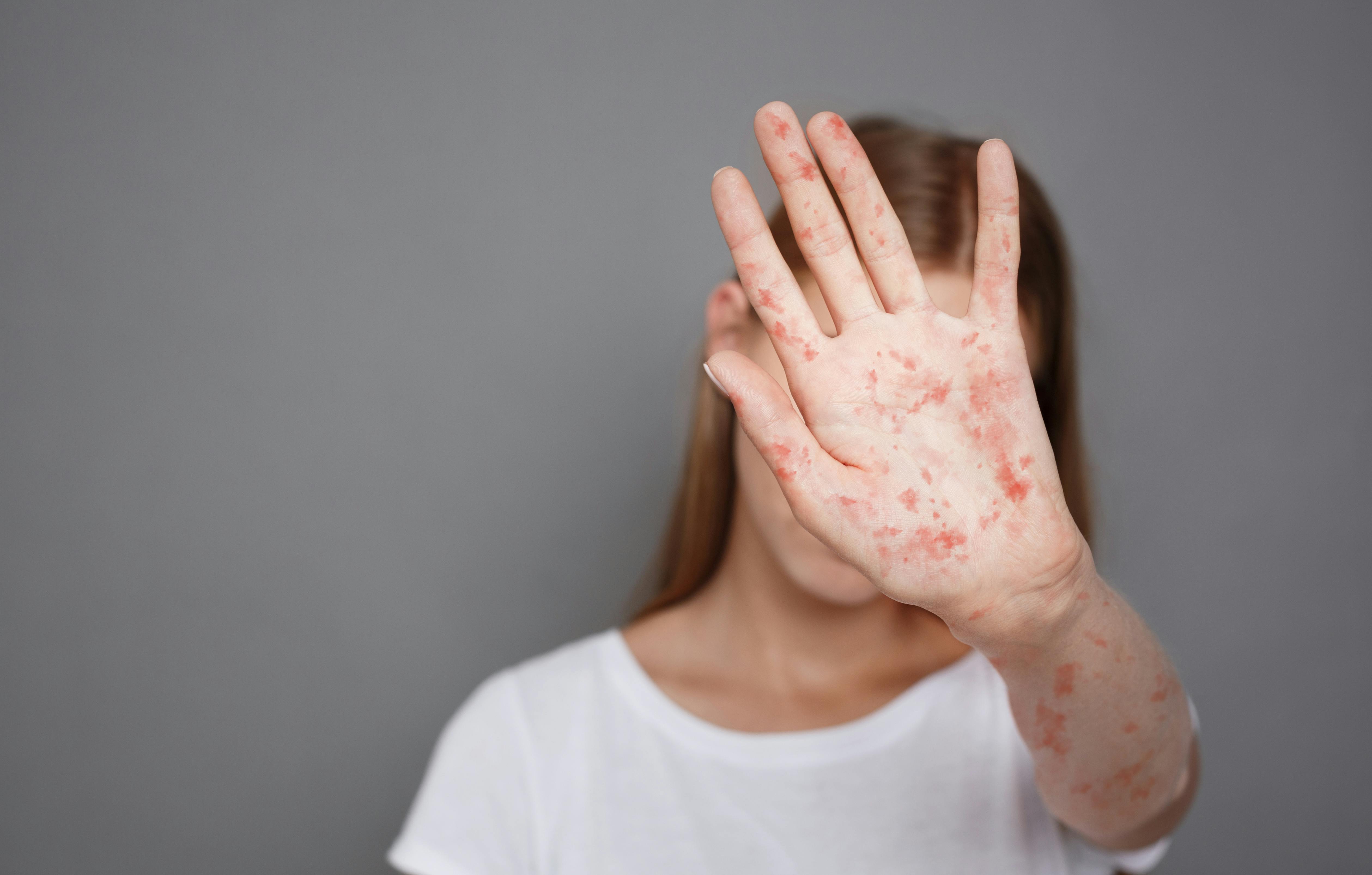 6848cdf6e547986a1095675a Dreamstime Xxl 146842674