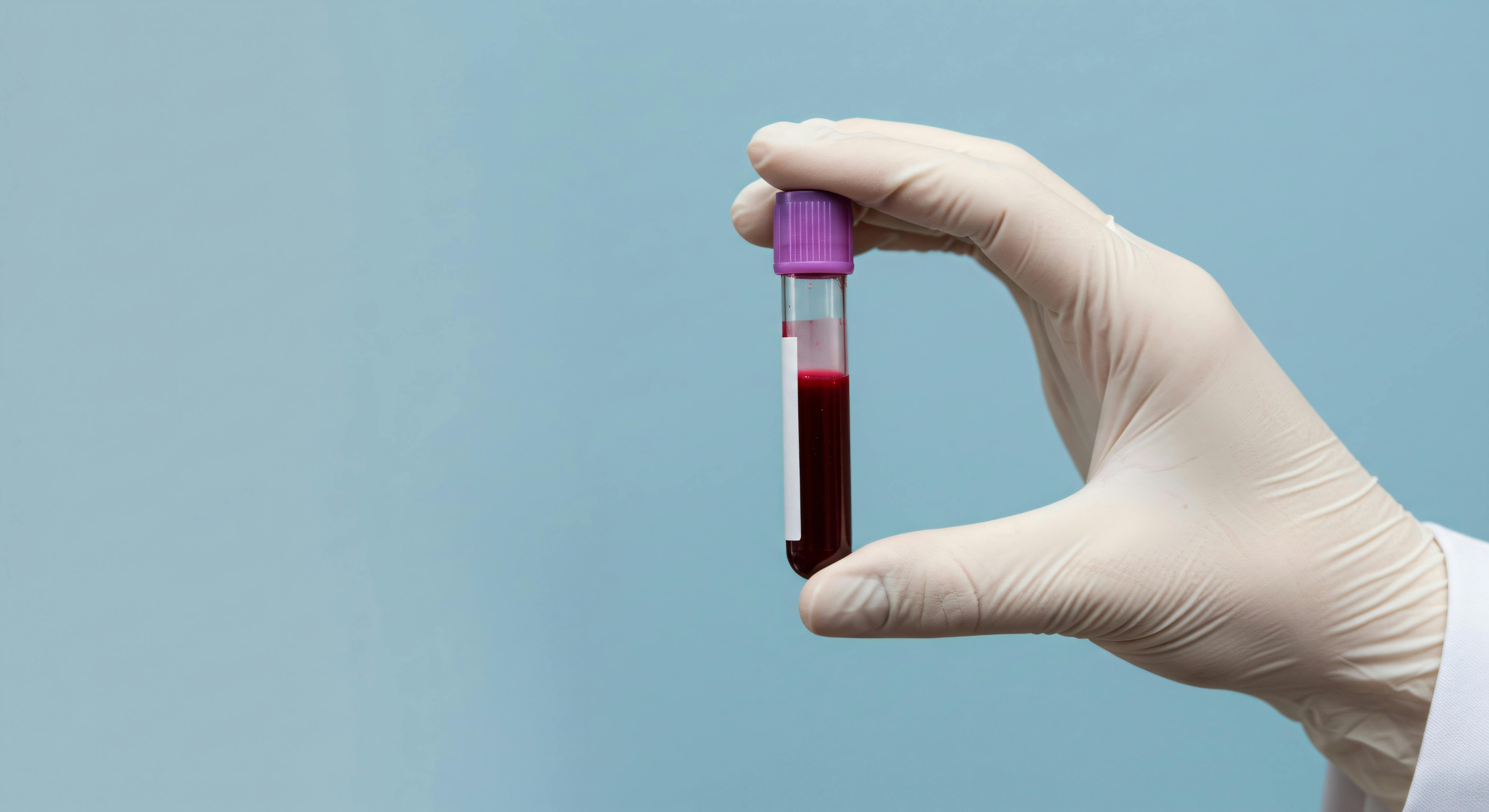 adobestock_1538697439