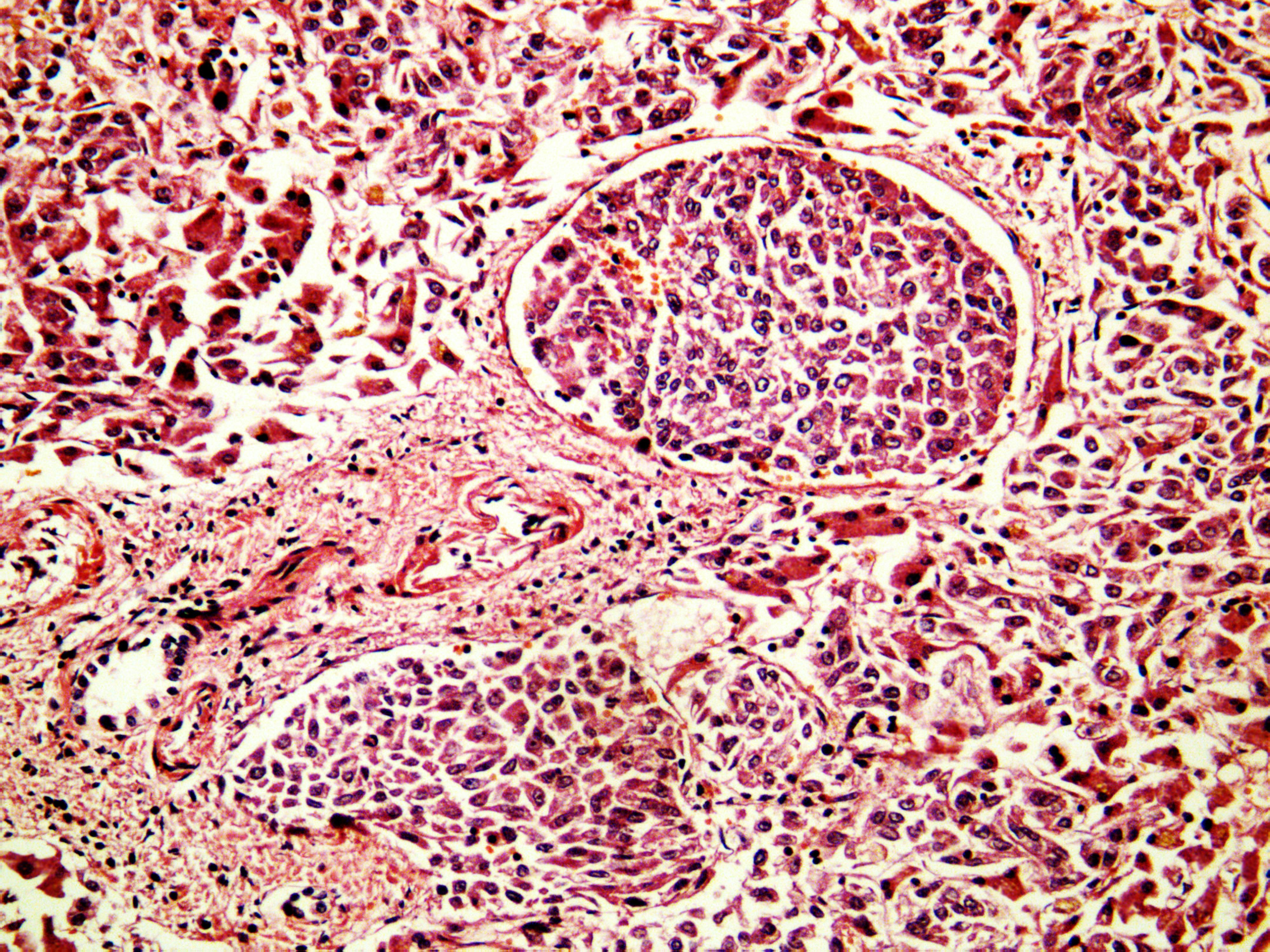 dreamstime_xxl_29670818