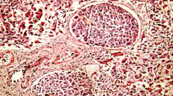 dreamstime_xxl_29670818_1 dreamstime_xxl_29670818_1