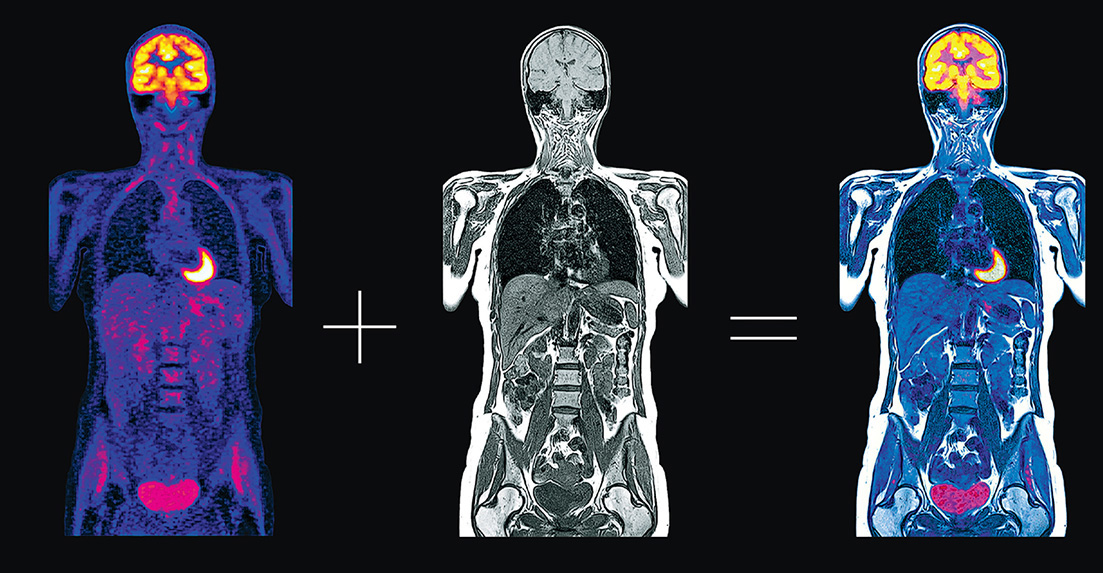 Microwaves May Take on Medical Diagnostics