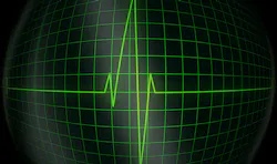 UWB Technology Makes RF the Doctor UWB Technology Makes RF the Doctor