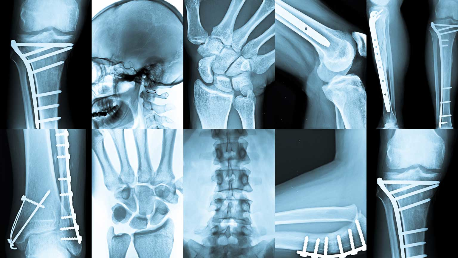 Xray Dreamstime Ultra67 23559314 1 6543fff64a42e