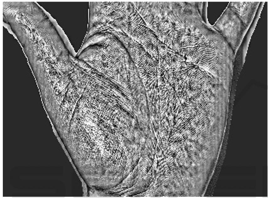 Optical scanning of hand for biomedical diagnosis