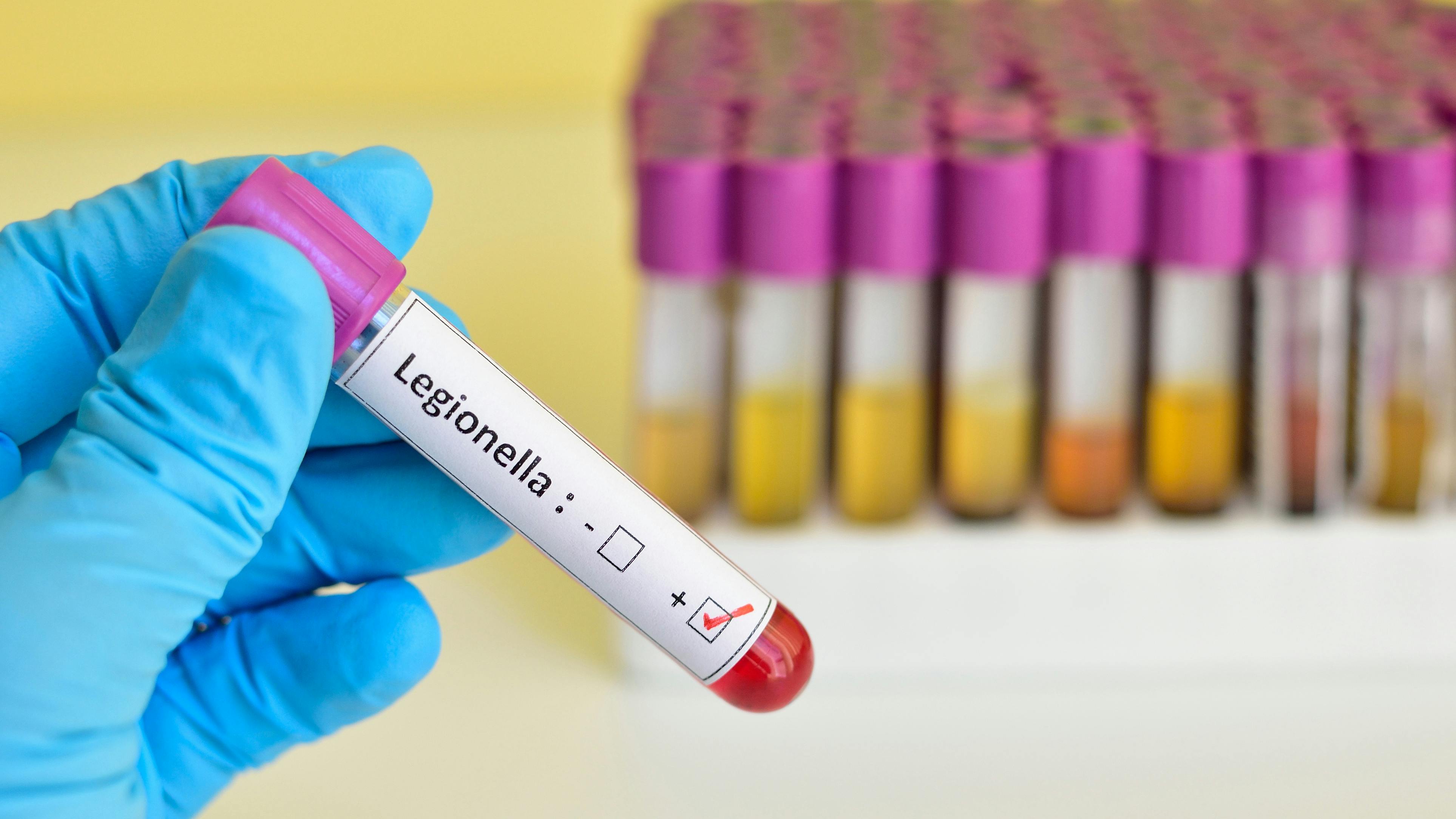 Legionella positive blood sample