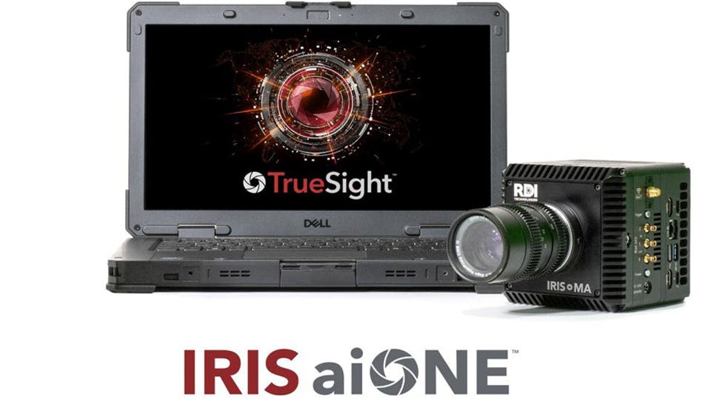 Iris aiOne Platform Motion Analysis System With AI Diagnostics
