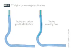 CT digital processing visualization (Fig. 2) CT digital processing visualization (Fig. 2)