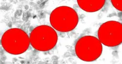 resizedimage290153-After_Morphological_Filter resizedimage290153-After_Morphological_Filter