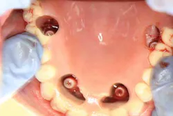 13nov7srrsimmonsao4 7 13nov7srrsimmonsao4 7