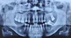 14apr10srrgardonmollardharmony01 14apr10srrgardonmollardharmony01