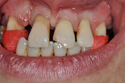 14apr10srrgardonmollardharmony02 14apr10srrgardonmollardharmony02