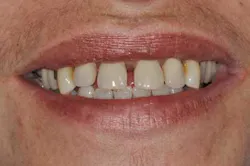 14apr10srrgardonmollardharmony03c 14apr10srrgardonmollardharmony03c