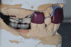 14apr10srrgardonmollardharmony06c 14apr10srrgardonmollardharmony06c