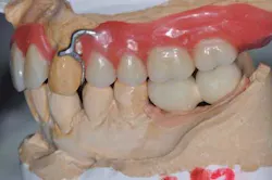 14apr10srrgardonmollardharmony07c 14apr10srrgardonmollardharmony07c