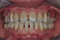 14apr10srrgardonmollardharmony08c 14apr10srrgardonmollardharmony08c