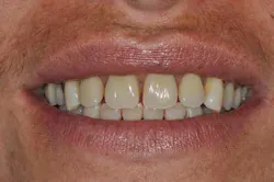 14apr10srrgardonmollardharmony08d 14apr10srrgardonmollardharmony08d