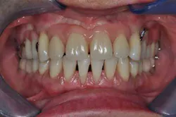 14apr10srrgardonmollardharmony09a 14apr10srrgardonmollardharmony09a