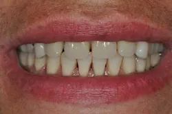 14apr10srrgardonmollardharmony09b 14apr10srrgardonmollardharmony09b