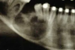 14feb27srrramerhpt Jt05 14feb27srrramerhpt Jt05