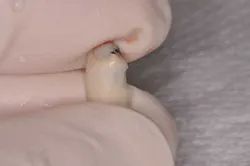 14jul10srrsaliernoflipper05 14jul10srrsaliernoflipper05