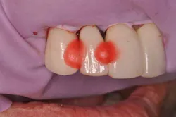 14jul10srrsaliernoflipper06 14jul10srrsaliernoflipper06